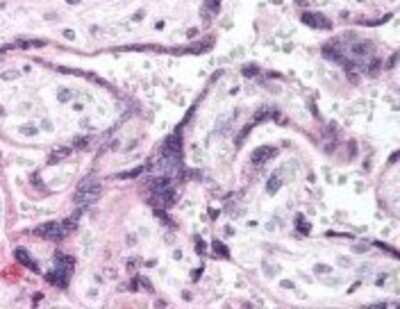 Immunohistochemistry-Paraffin: EGFR [p Tyr1197] Antibody [NBP1-77936]
